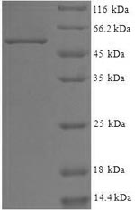 Recombinant Human WD repeat-containing protein 5 (WDR5) – Figure 1 of 1