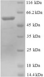 Recombinant Human DDB1- and CUL4-associated factor 7 (DCAF7) – Figure 1 of 1