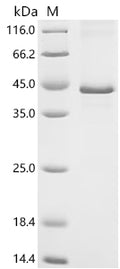 (Tris-Glycine gel) Discontinuous SDS-PAGE (reduced) with 5% enrichment gel and 15% separation gel.