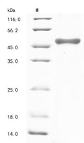 (Tris-Glycine gel) Discontinuous SDS-PAGE (reduced) with 5% enrichment gel and 15% separation gel.
