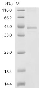 (Tris-Glycine gel) Discontinuous SDS-PAGE (reduced) with 5% enrichment gel and 15% separation gel.