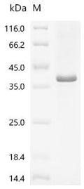 (Tris-Glycine gel) Discontinuous SDS-PAGE (reduced) with 5% enrichment gel and 15% separation gel.