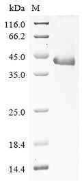 (Tris-Glycine gel) Discontinuous SDS-PAGE (reduced) with 5% enrichment gel and 15% separation gel.