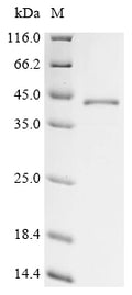 (Tris-Glycine gel) Discontinuous SDS-PAGE (reduced) with 5% enrichment gel and 15% separation gel.