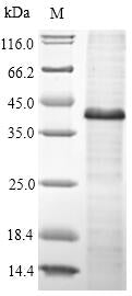 (Tris-Glycine gel) Discontinuous SDS-PAGE (reduced) with 5% enrichment gel and 15% separation gel.