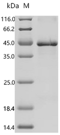 (Tris-Glycine gel) Discontinuous SDS-PAGE (reduced) with 5% enrichment gel and 15% separation gel.