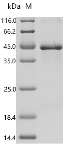 (Tris-Glycine gel) Discontinuous SDS-PAGE (reduced) with 5% enrichment gel and 15% separation gel.