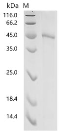 (Tris-Glycine gel) Discontinuous SDS-PAGE (reduced) with 5% enrichment gel and 15% separation gel.