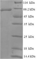 Recombinant Human Wilms tumor protein (WT1) – Figure 1 of 1