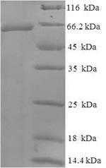 Recombinant Human Wilms tumor protein (WT1) – Figure 1 of 1