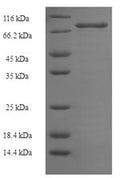 Recombinant Human E3 ubiquitin-protein ligase XIAP (XIAP) – Figure 1 of 1