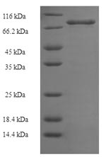 Recombinant Human E3 ubiquitin-protein ligase XIAP (XIAP) – Figure 1 of 1
