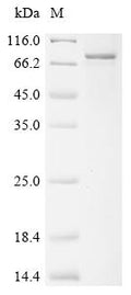 (Tris-Glycine gel) Discontinuous SDS-PAGE (reduced) with 5% enrichment gel and 15% separation gel.