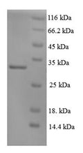 Recombinant Human DNA repair protein complementing XP-C cells (XPC), partial – Figure 1 of 1