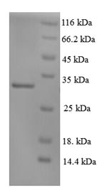 Recombinant Human DNA repair protein complementing XP-C cells (XPC), partial – Figure 1 of 1
