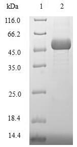 Recombinant Human DNA repair protein XRCC3 (XRCC3) – Figure 1 of 1