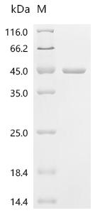 (Tris-Glycine gel) Discontinuous SDS-PAGE (reduced) with 5% enrichment gel and 15% separation gel.