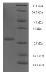 Recombinant Human Protein yippee-like 1 (YPEL1) – Figure 1 of 1