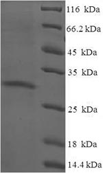 Recombinant Human Protein yippee-like 3 (YPEL3) – Figure 1 of 1