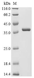 (Tris-Glycine gel) Discontinuous SDS-PAGE (reduced) with 5% enrichment gel and 15% separation gel.