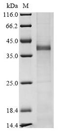 (Tris-Glycine gel) Discontinuous SDS-PAGE (reduced) with 5% enrichment gel and 15% separation gel.