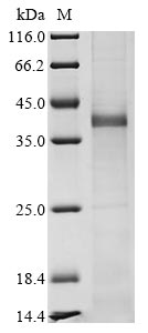 (Tris-Glycine gel) Discontinuous SDS-PAGE (reduced) with 5% enrichment gel and 15% separation gel.