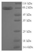 Recombinant Human Zinc finger protein 114 (ZNF114), partial – Figure 1 of 1