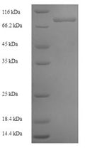 Recombinant Human Zinc finger protein 155 (ZNF155) – Figure 1 of 1