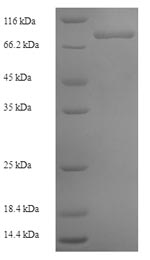 Recombinant Human Zinc finger protein 155 (ZNF155) – Figure 1 of 1