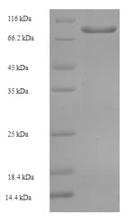 Recombinant Human Zinc finger protein 165 (ZNF165) – Figure 1 of 1