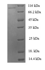 Recombinant Human Zinc finger protein 175 (ZNF175) – Figure 1 of 1