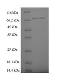 Recombinant Human Zinc finger protein 212 (ZNF212) – Figure 1 of 1
