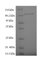 Recombinant Human Zinc finger protein 212 (ZNF212) – Figure 1 of 1