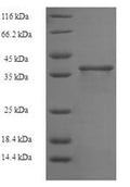 Recombinant Human Zinc finger protein 26 (ZNF26), partial – Figure 1 of 1