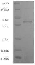 Recombinant Human Zinc finger protein 581 (ZNF581) – Figure 1 of 1