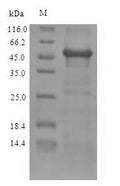 Recombinant Human Zinc finger Ran-binding domain-containing protein 2 (ZRANB2) – Figure 1 of 1