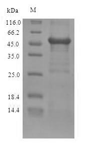 Recombinant Human Zinc finger Ran-binding domain-containing protein 2 (ZRANB2) – Figure 1 of 1