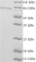 Recombinant Human Zinc finger and SCAN domain-containing protein 20 (ZSCAN20) – Figure 1 of 1