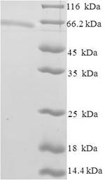 Recombinant Human Zinc finger and SCAN domain-containing protein 20 (ZSCAN20) – Figure 1 of 1