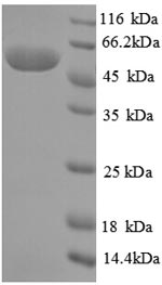 Recombinant Pseudomonas putida Creatinine amidohydrolase (crnA) – Figure 1 of 1