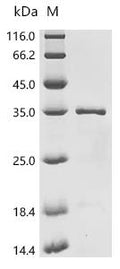 (Tris-Glycine gel) Discontinuous SDS-PAGE (reduced) with 5% enrichment gel and 15% separation gel.