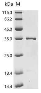 (Tris-Glycine gel) Discontinuous SDS-PAGE (reduced) with 5% enrichment gel and 15% separation gel.
