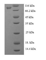 Recombinant Japanese encephalitis virus Genome polyprotein, partial – Figure 1 of 1