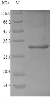 (Tris-Glycine gel) Discontinuous SDS-PAGE (reduced) with 5% enrichment gel and 15% separation gel.