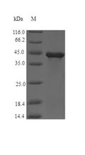 (Tris-Glycine gel) Discontinuous SDS-PAGE (reduced) with 5% enrichment gel and 15% separation gel.
