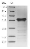 (Tris-Glycine gel) Discontinuous SDS-PAGE (reduced) with 5% enrichment gel and 15% separation gel.