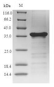 (Tris-Glycine gel) Discontinuous SDS-PAGE (reduced) with 5% enrichment gel and 15% separation gel.