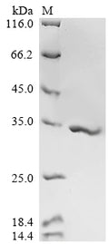 (Tris-Glycine gel) Discontinuous SDS-PAGE (reduced) with 5% enrichment gel and 15% separation gel.