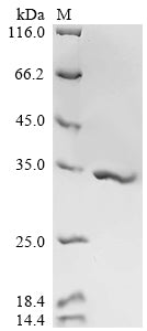 (Tris-Glycine gel) Discontinuous SDS-PAGE (reduced) with 5% enrichment gel and 15% separation gel.