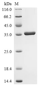 (Tris-Glycine gel) Discontinuous SDS-PAGE (reduced) with 5% enrichment gel and 15% separation gel.